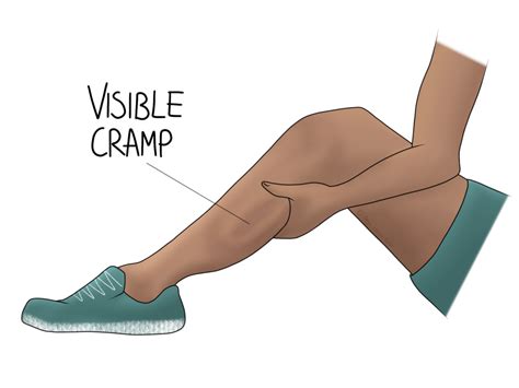 CRAMP .